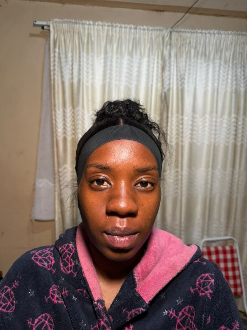 Client before makeup